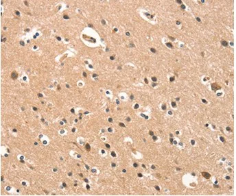 Immunohistochemistry (Formalin/PFA-fixed paraffin-embedded sections) - Anti-CYP46A1 antibody (AB198889)