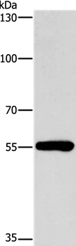 Western blot - Anti-CYP46A1 antibody (AB198889)