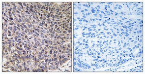 Immunohistochemistry (Formalin/PFA-fixed paraffin-embedded sections) - Anti-CYP4B1 antibody (AB110012), expandable thumbnail
