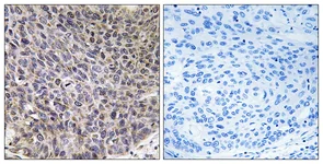 Immunohistochemistry (Formalin/PFA-fixed paraffin-embedded sections) - Anti-CYP4B1 antibody (AB110012)