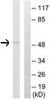 Western blot - Anti-CYP4B1 antibody (AB110012), expandable thumbnail