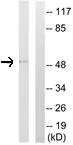 Western blot - Anti-CYP4B1 antibody (AB110012)