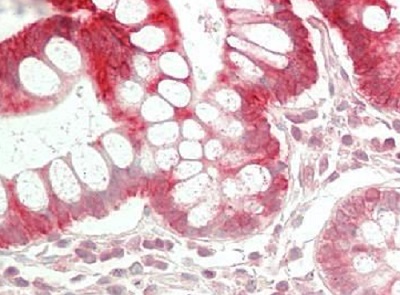 Immunohistochemistry (Formalin/PFA-fixed paraffin-embedded sections) - Anti-CYP4F2 antibody - N-terminal (AB230709)