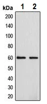Western blot - Anti-CYP4F2 antibody - N-terminal (AB230709)