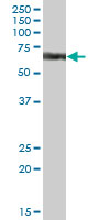 Western blot - Anti-CYP4V2 antibody (AB69392)