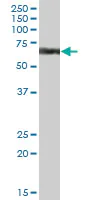 Western blot - Anti-CYP4V2 antibody (AB69392)
