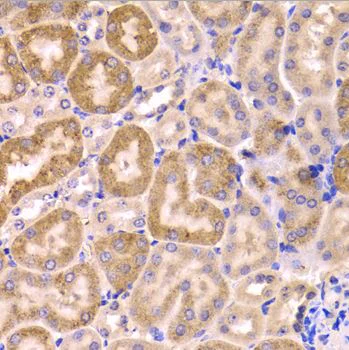 Immunohistochemistry (Formalin/PFA-fixed paraffin-embedded sections) - Anti-CYP51A1/CYP51 antibody (AB210792)