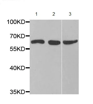 Western blot - Anti-CYP51A1/CYP51 antibody (AB210792)