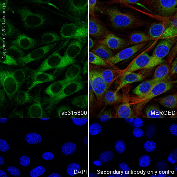 Immunocytochemistry/ Immunofluorescence - Anti-CYP51A1/CYP51 antibody [EPR27379-150] (AB315800)