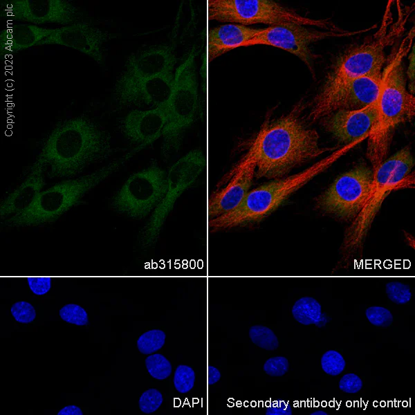 Immunocytochemistry/ Immunofluorescence - Anti-CYP51A1/CYP51 antibody [EPR27379-150] (AB315800)