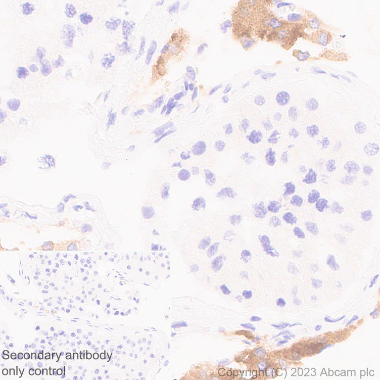 Immunohistochemistry (Formalin/PFA-fixed paraffin-embedded sections) - Anti-CYP51A1/CYP51 antibody [EPR27379-150] (AB315800)