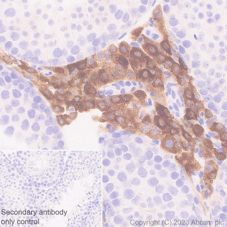 Immunohistochemistry (Formalin/PFA-fixed paraffin-embedded sections) - Anti-CYP51A1/CYP51 antibody [EPR27379-150] (AB315800)