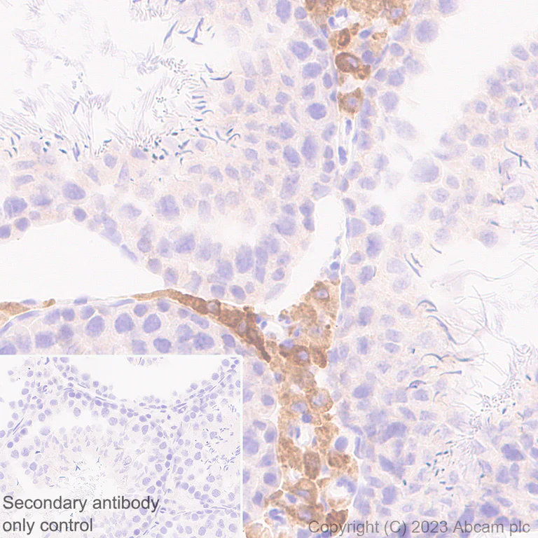 Immunohistochemistry (Formalin/PFA-fixed paraffin-embedded sections) - Anti-CYP51A1/CYP51 antibody [EPR27379-150] (AB315800)