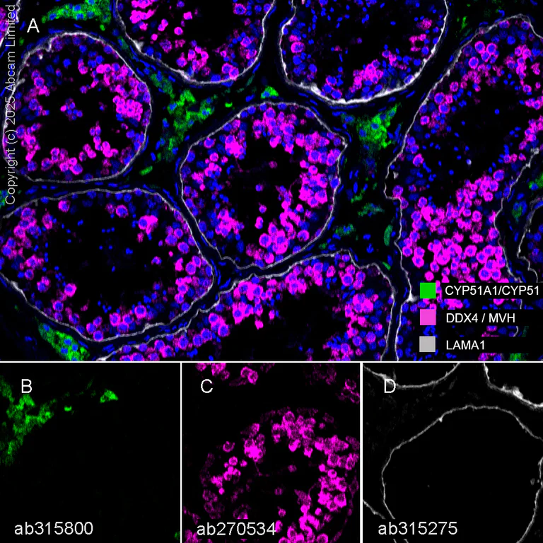 Multiplex immunohistochemistry - Anti-CYP51A1/CYP51 antibody [EPR27379-150] (AB315800)
