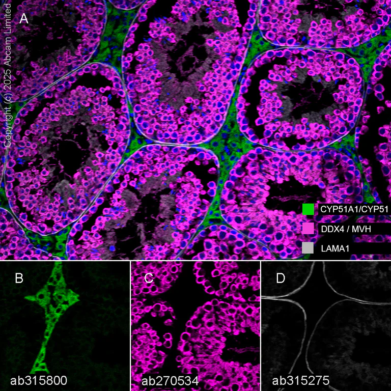 Multiplex immunohistochemistry - Anti-CYP51A1/CYP51 antibody [EPR27379-150] (AB315800)