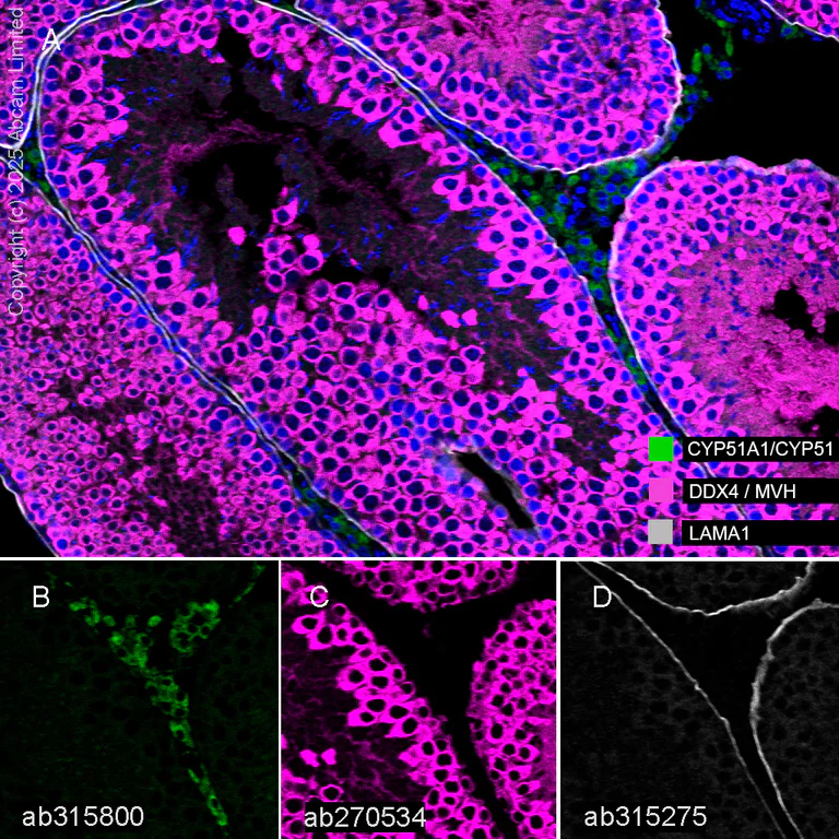Multiplex immunohistochemistry - Anti-CYP51A1/CYP51 antibody [EPR27379-150] (AB315800)
