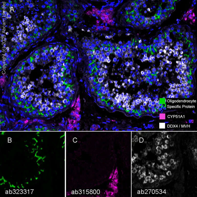 Multiplex immunohistochemistry - Anti-CYP51A1/CYP51 antibody [EPR27379-150] (AB315800)