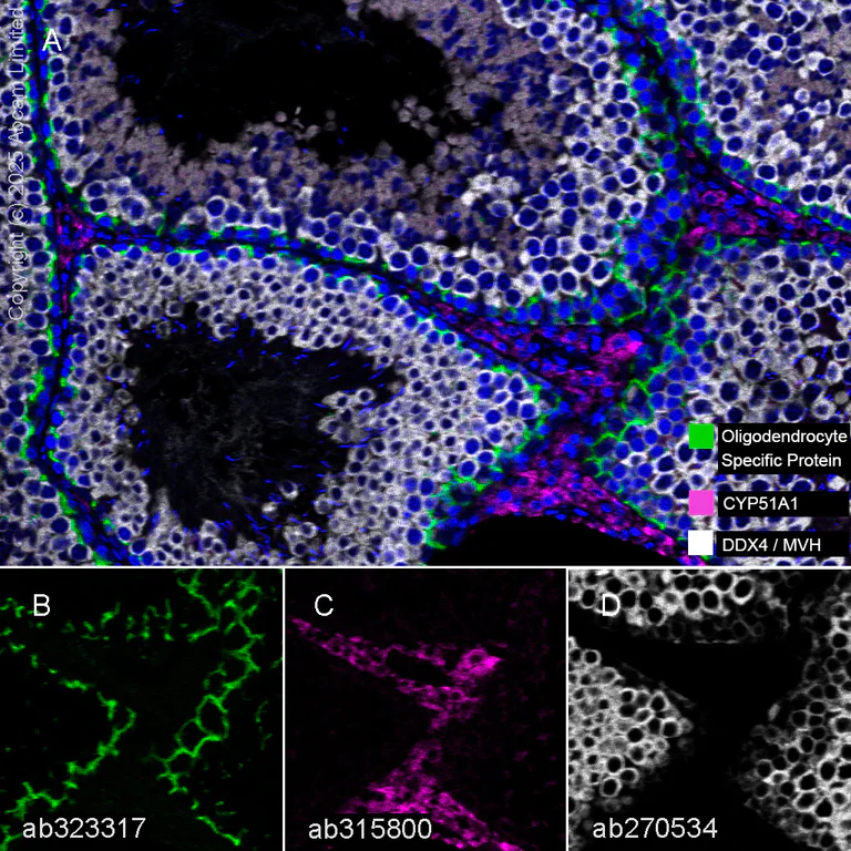 Multiplex immunohistochemistry - Anti-CYP51A1/CYP51 antibody [EPR27379-150] (AB315800)