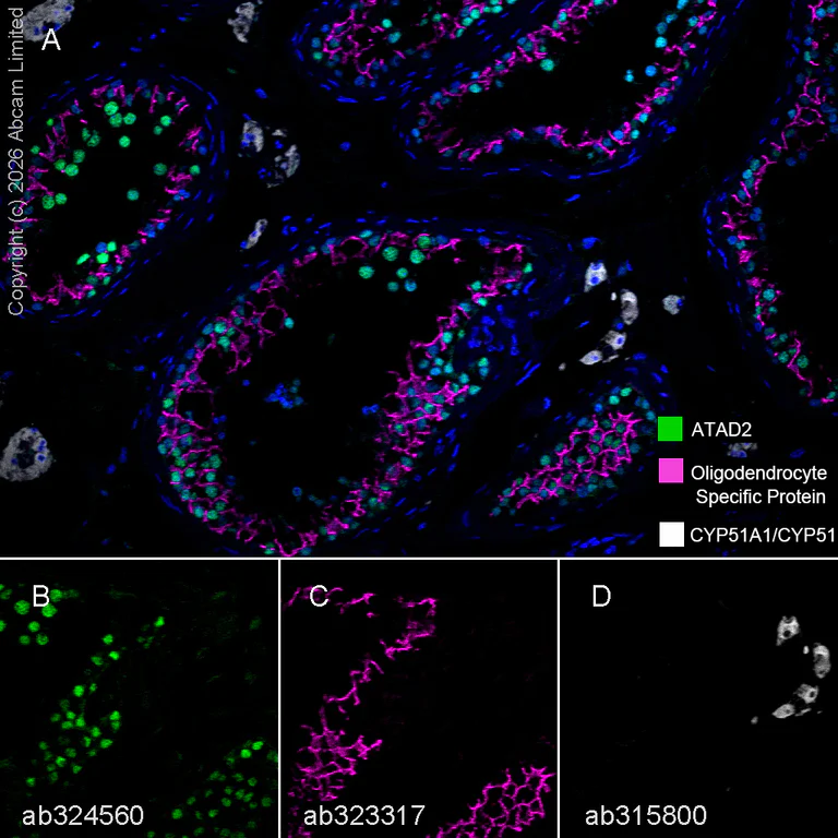 Multiplex immunohistochemistry - Anti-CYP51A1/CYP51 antibody [EPR27379-150] (AB315800)