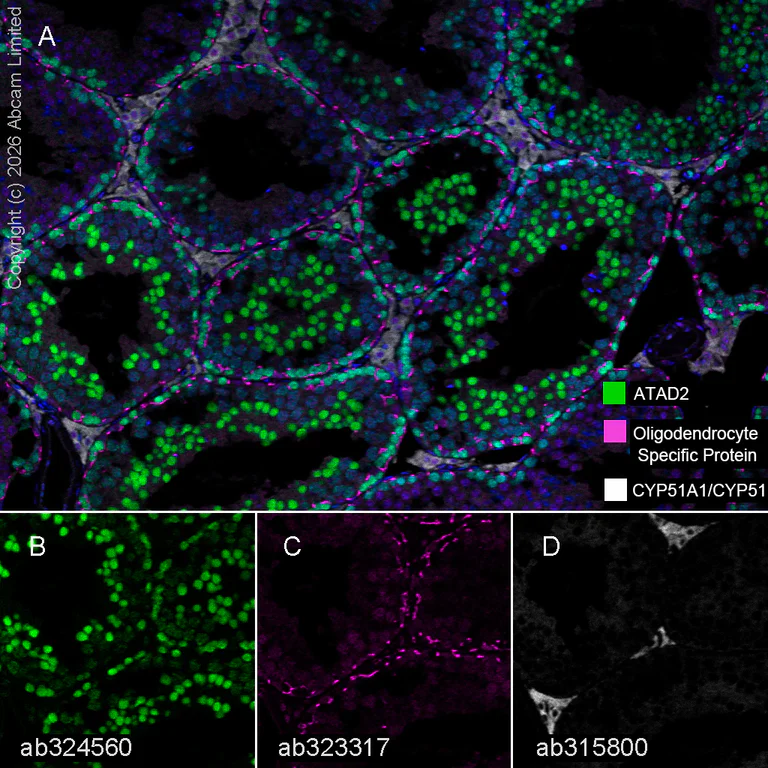 Multiplex immunohistochemistry - Anti-CYP51A1/CYP51 antibody [EPR27379-150] (AB315800)