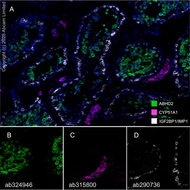 Multiplex immunohistochemistry - Anti-CYP51A1/CYP51 antibody [EPR27379-150] (AB315800)