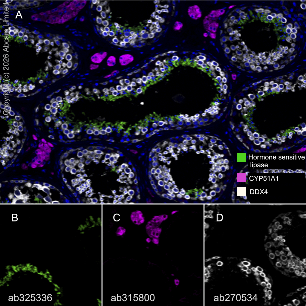 Multiplex immunohistochemistry - Anti-CYP51A1/CYP51 antibody [EPR27379-150] (AB315800)