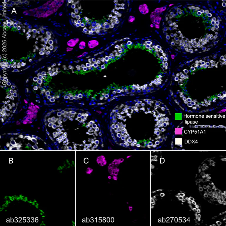 Multiplex immunohistochemistry - Anti-CYP51A1/CYP51 antibody [EPR27379-150] (AB315800)