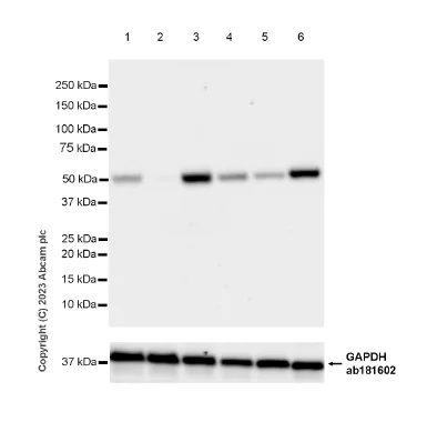 Western blot - Anti-CYP51A1/CYP51 antibody [EPR27379-150] (AB315800)