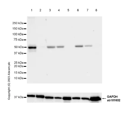 Western blot - Anti-CYP51A1/CYP51 antibody [EPR27379-150] (AB315800)