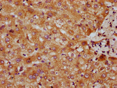 Immunohistochemistry (Formalin/PFA-fixed paraffin-embedded sections) - Anti-CYP7A1 antibody (AB234982)