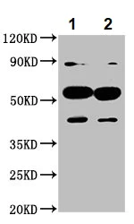 Western blot - Anti-CYP7A1 antibody (AB234982)