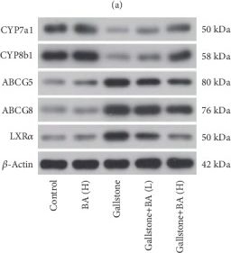 Western blot - Anti-CYP8B1 antibody (AB191910)