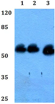 Western blot - Anti-CYP8B1 antibody (AB191910)