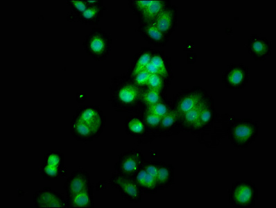 Immunocytochemistry/ Immunofluorescence - Anti-CYP8B1 antibody (AB236607), expandable thumbnail