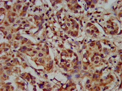 Immunohistochemistry (Formalin/PFA-fixed paraffin-embedded sections) - Anti-CYP8B1 antibody (AB236607), expandable thumbnail