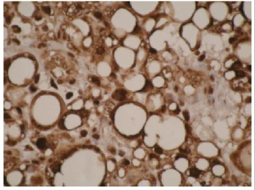 Immunohistochemistry (Formalin/PFA-fixed paraffin-embedded sections) - Anti-CYPIVF11 antibody [F21 P6 F5] (AB55841)