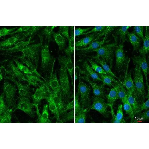 Immunocytochemistry/ Immunofluorescence - Anti-CYR61 antibody [HL2144] (AB317144)