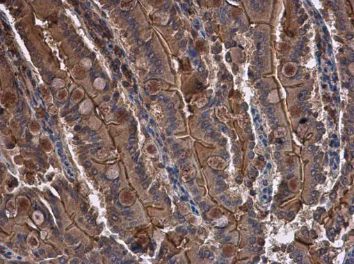 Immunohistochemistry (Formalin/PFA-fixed paraffin-embedded sections) - Anti-CYR61/CCN1 antibody (AB228592)