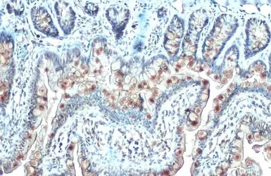 Immunohistochemistry (Formalin/PFA-fixed paraffin-embedded sections) - Anti-CYR61/CCN1 antibody (AB228592)