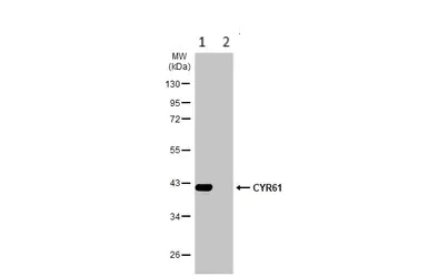 Western blot - Anti-CYR61/CCN1 antibody (AB228592)