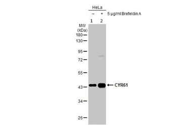 Western blot - Anti-CYR61/CCN1 antibody (AB228592)