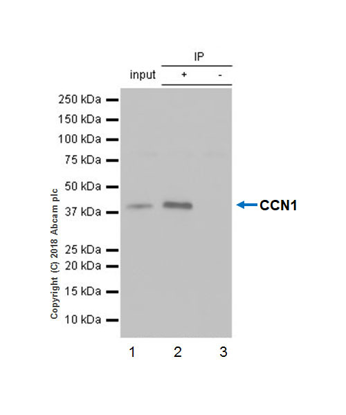 Anti-CYR61/CCN1 antibody [EPR20681]