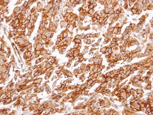 Immunohistochemistry (Formalin/PFA-fixed paraffin-embedded sections) - Anti-CysLT1 antibody - N-terminal (AB151484)