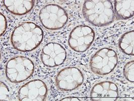 Immunohistochemistry (Formalin/PFA-fixed paraffin-embedded sections) - Anti-Cystathionase/CTH antibody [2E12-1C10] (AB54573)