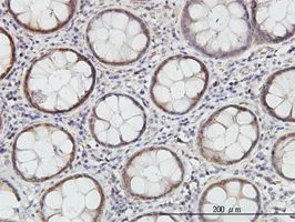 Immunohistochemistry (Formalin/PFA-fixed paraffin-embedded sections) - Anti-Cystathionase/CTH antibody [2E12-1C10] (AB54573)