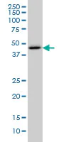 Western blot - Anti-Cystathionase/CTH antibody [2E12-1C10] (AB54573)