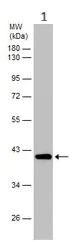 Western blot - Anti-Cystathionase/CTH antibody (AB151769)