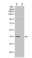 Western blot - Anti-Cystathionase/CTH antibody (AB151769)