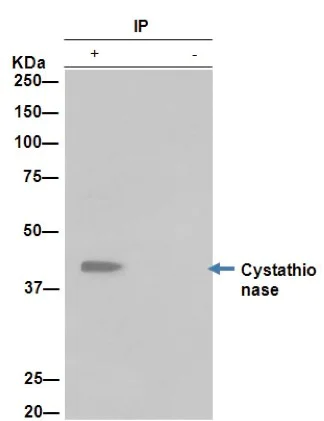 Immunoprecipitation - Anti-Cystathionase/CTH antibody [EPR15468] - N-terminal (AB189916)
