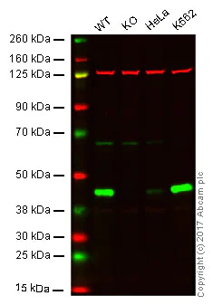 Western blot - Anti-Cystathionase/CTH antibody [EPR15468] - N-terminal (AB189916)